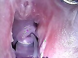BurningAngel Extreme Rectal Ejaculation