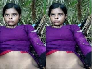 Indian girl with congenital thicket sets a record for lover